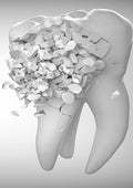 Odontología 004 - Cuadro canvas Canvaradas