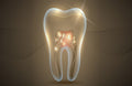 Odontología 023 - Cuadro canvas Canvaradas